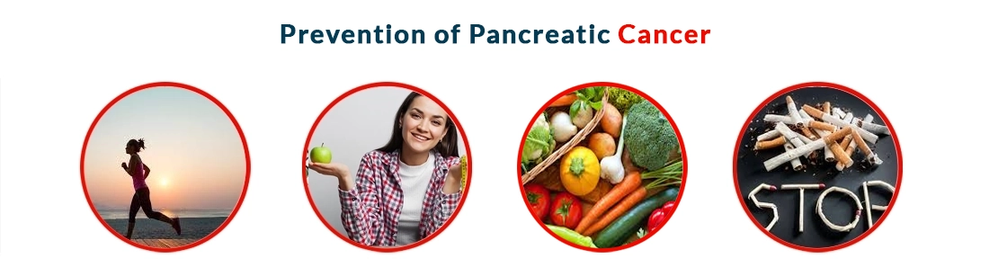 Prevention of Pancreatic Cancer